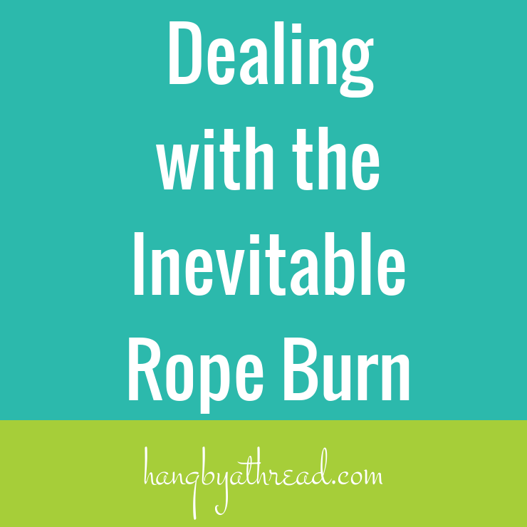 Rope burns! They happen when you're an aerialist. Here's how I dealt with my worst one.